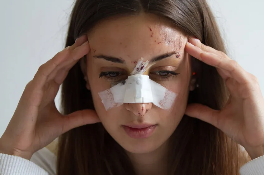 Facial Injury Repair
